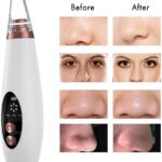 Extrator Cravos Aparelho Removedor A Vácuo Recarregável 6 - Markelk Profissional - Miniatura 6